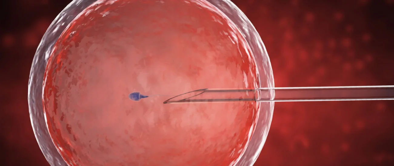 AI Hidden Sperm Breakthrough in Infertility 2026.