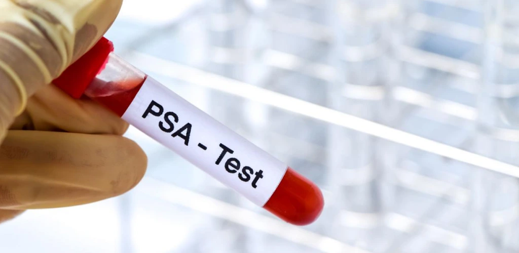 UK Prostate Cancer Screening Shift